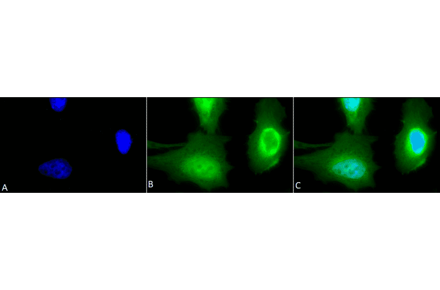 Immunocytochemistry/Immunofluorescence - Anti-Calreticulin Antibody (A305091) - Antibodies.com