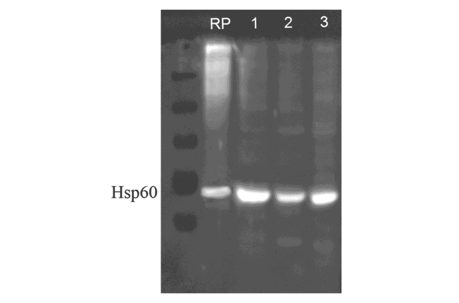 Western Blot - Anti-HSP60 Antibody (A305092) - Antibodies.com