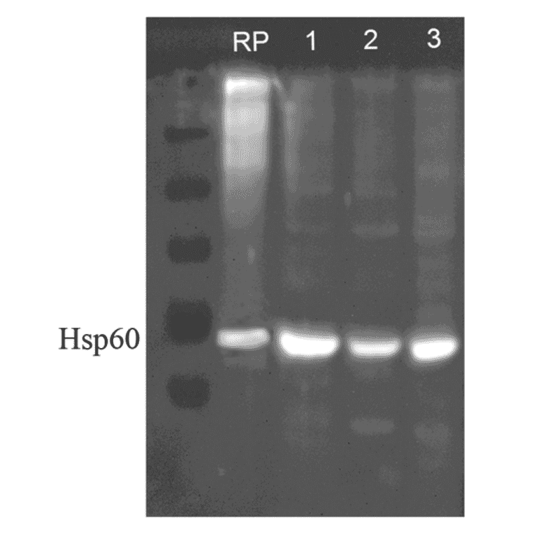Western Blot - Anti-HSP60 Antibody (A305092) - Antibodies.com