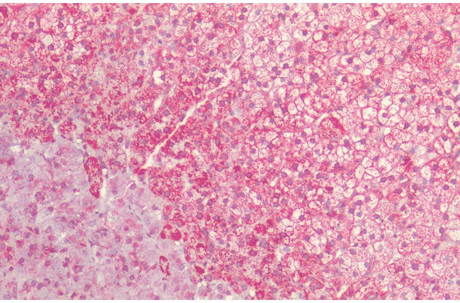 Immunohistochemistry - Anti-HSP60 Antibody (A305092) - Antibodies.com
