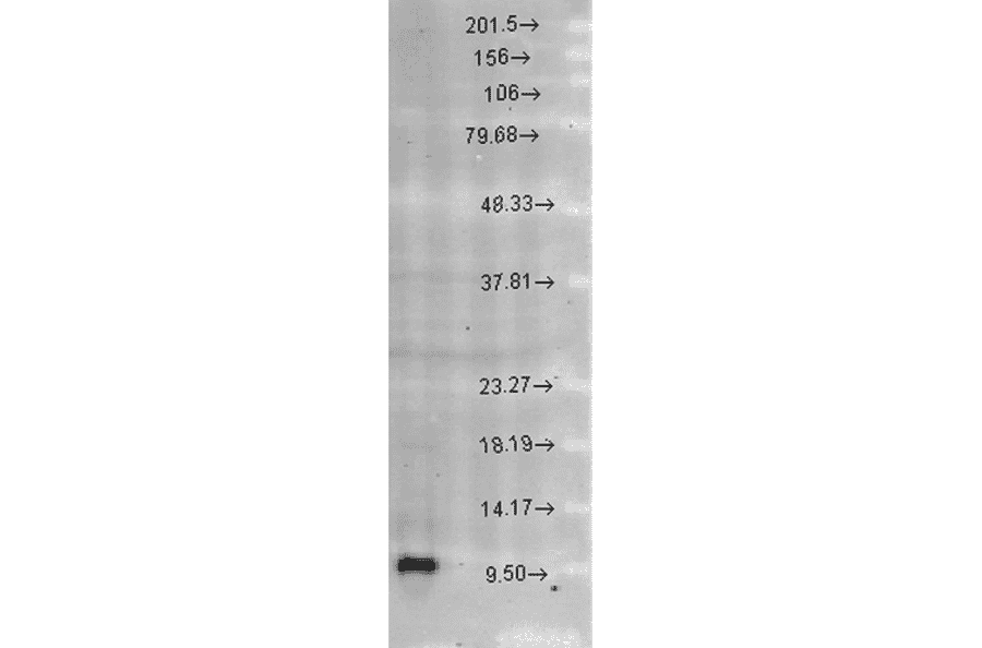 Western Blot - Anti-EPF Antibody (A305094) - Antibodies.com