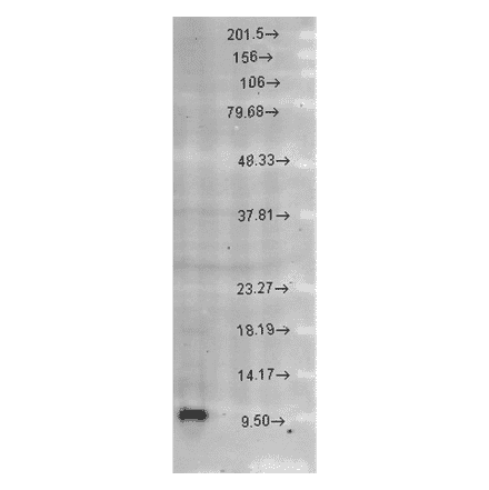 Western Blot - Anti-EPF Antibody (A305094) - Antibodies.com