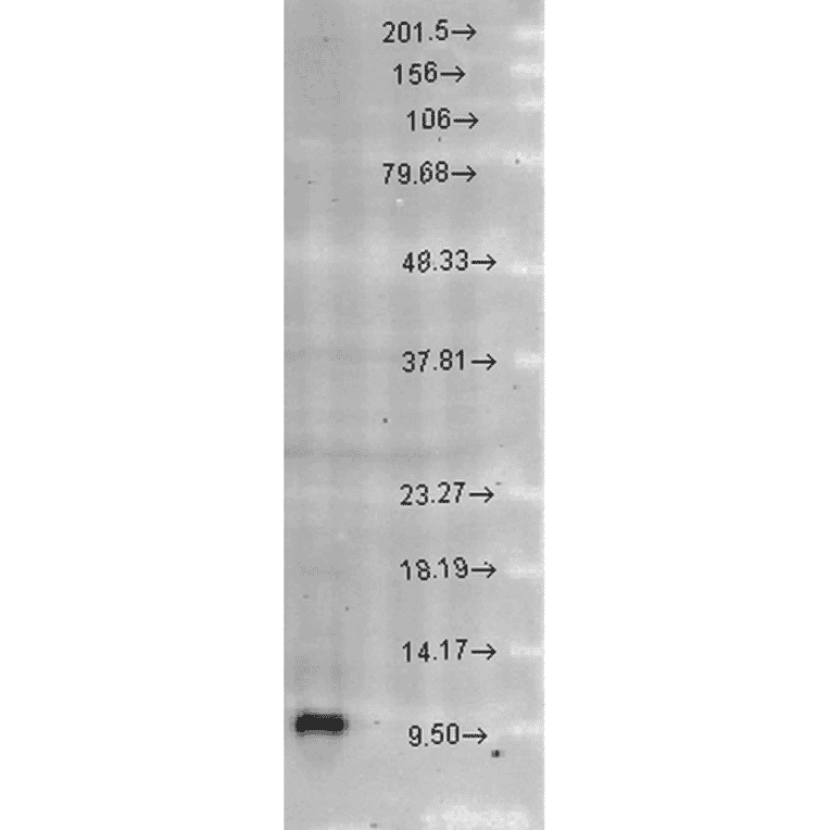 Western Blot - Anti-EPF Antibody (A305094) - Antibodies.com