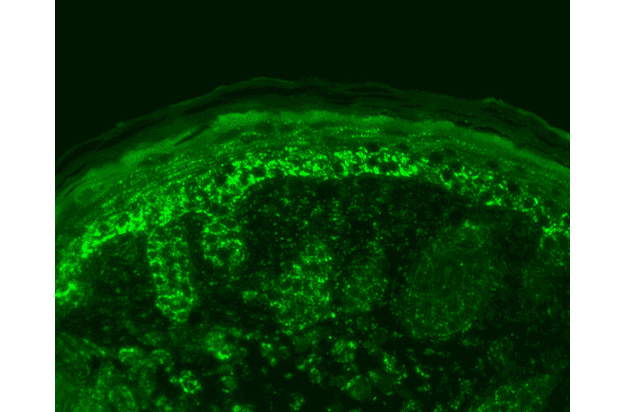 Immunohistochemistry - Anti-EPF Antibody (A305094) - Antibodies.com