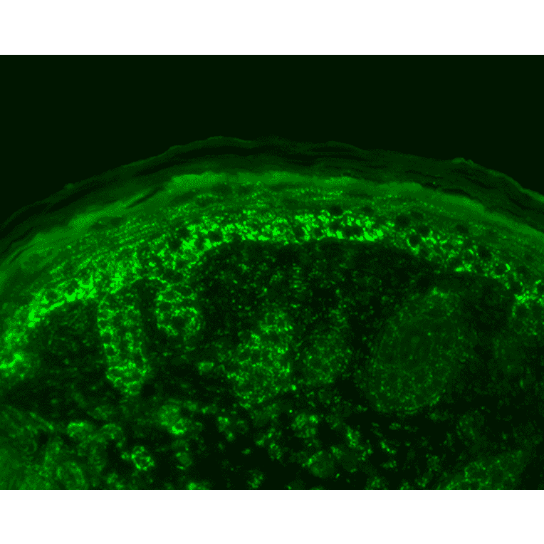 Immunohistochemistry - Anti-EPF Antibody (A305094) - Antibodies.com