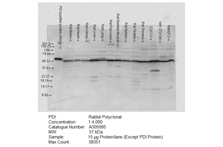 Western Blot - Anti-PDIA2 / PDIP Antibody (A305095) - Antibodies.com