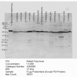 Western Blot - Anti-PDIA2 / PDIP Antibody (A305095) - Antibodies.com