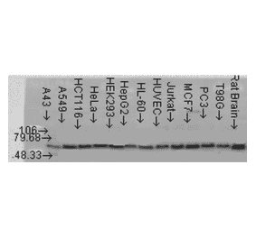 Western Blot - Anti-AKT2 Antibody (A305096) - Antibodies.com