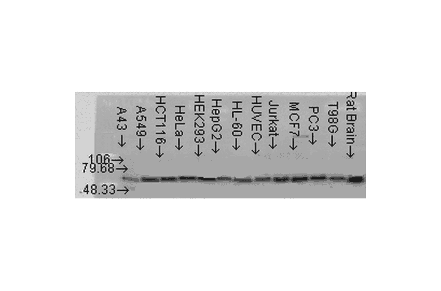 Western Blot - Anti-AKT2 Antibody (A305096) - Antibodies.com