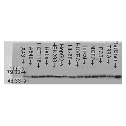 Western Blot - Anti-AKT2 Antibody (A305096) - Antibodies.com