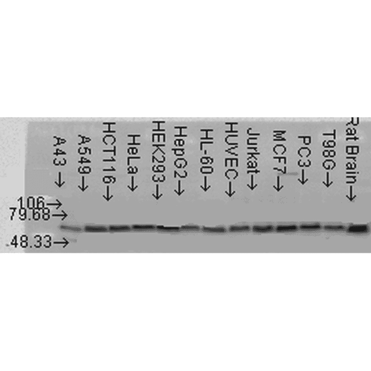 Western Blot - Anti-AKT2 Antibody (A305096) - Antibodies.com