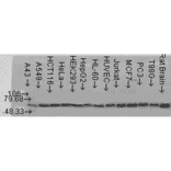 Western Blot - Anti-AKT2 Antibody (A305096) - Antibodies.com