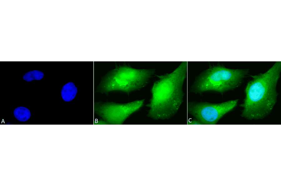 Immunocytochemistry/Immunofluorescence - Anti-AKT2 Antibody (A305096) - Antibodies.com