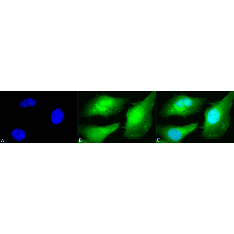 Immunocytochemistry/Immunofluorescence - Anti-AKT2 Antibody (A305096) - Antibodies.com