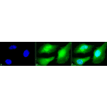 Immunocytochemistry/Immunofluorescence - Anti-AKT2 Antibody (A305096) - Antibodies.com