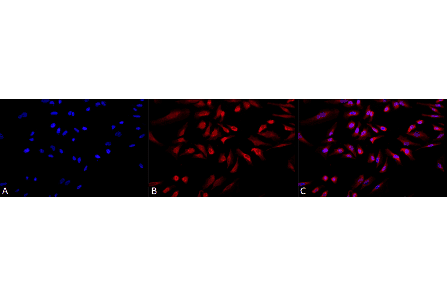 Immunocytochemistry/Immunofluorescence - Anti-GRP78 Antibody (A305100) - Antibodies.com