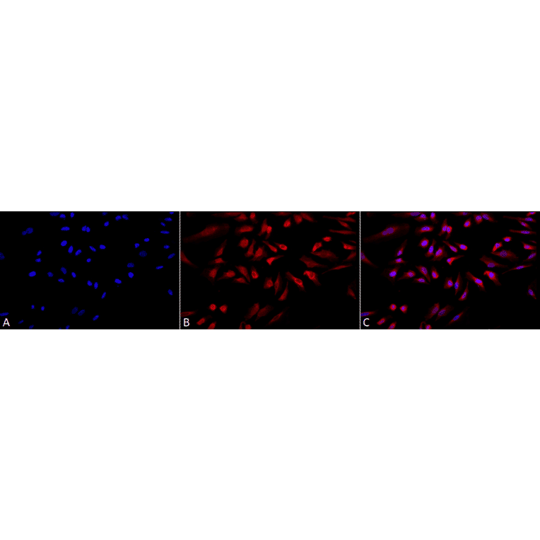 Immunocytochemistry/Immunofluorescence - Anti-GRP78 Antibody (A305100) - Antibodies.com