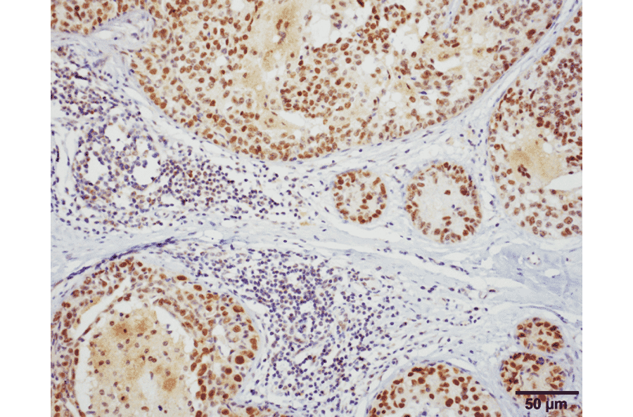 Immunohistochemistry - Anti-HSF1 Antibody [10H8] (A305101) - Antibodies.com