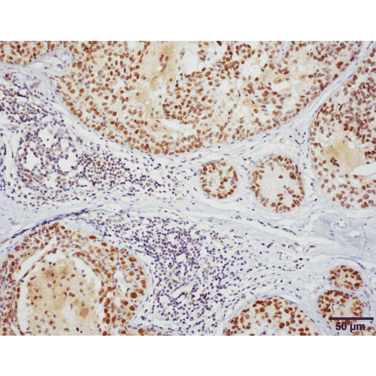 Immunohistochemistry - Anti-HSF1 Antibody [10H8] (A305101) - Antibodies.com