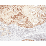 Immunohistochemistry - Anti-HSF1 Antibody [10H4] (A305102) - Antibodies.com