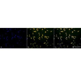 Immunocytochemistry/Immunofluorescence - Anti-Rab5 Antibody (A305104) - Antibodies.com
