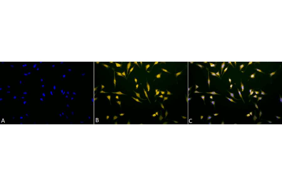 Immunocytochemistry/Immunofluorescence - Anti-Rab5 Antibody (A305104) - Antibodies.com