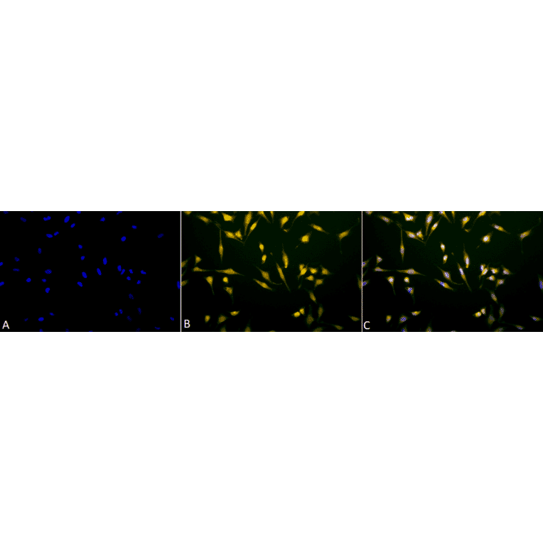 Immunocytochemistry/Immunofluorescence - Anti-Rab5 Antibody (A305104) - Antibodies.com