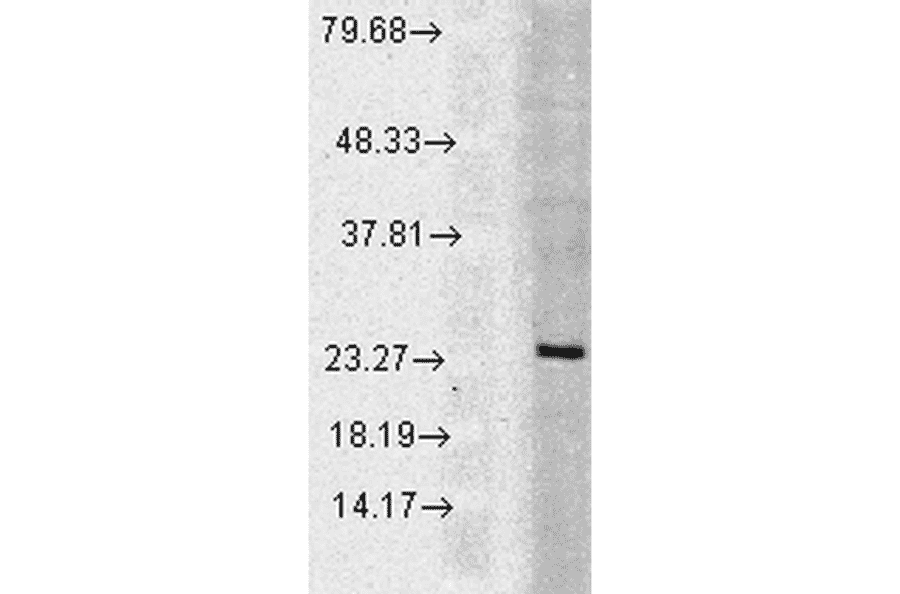 Western Blot - Anti-Rab5 Antibody (A305104) - Antibodies.com