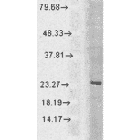 Western Blot - Anti-Rab5 Antibody (A305104) - Antibodies.com