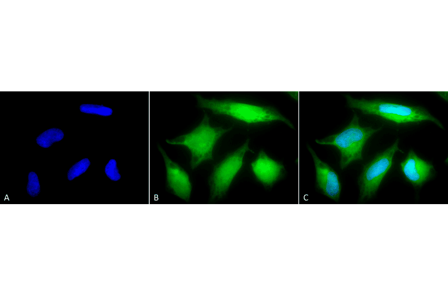 Immunocytochemistry/Immunofluorescence - Anti-Rab5 Antibody (A305104) - Antibodies.com