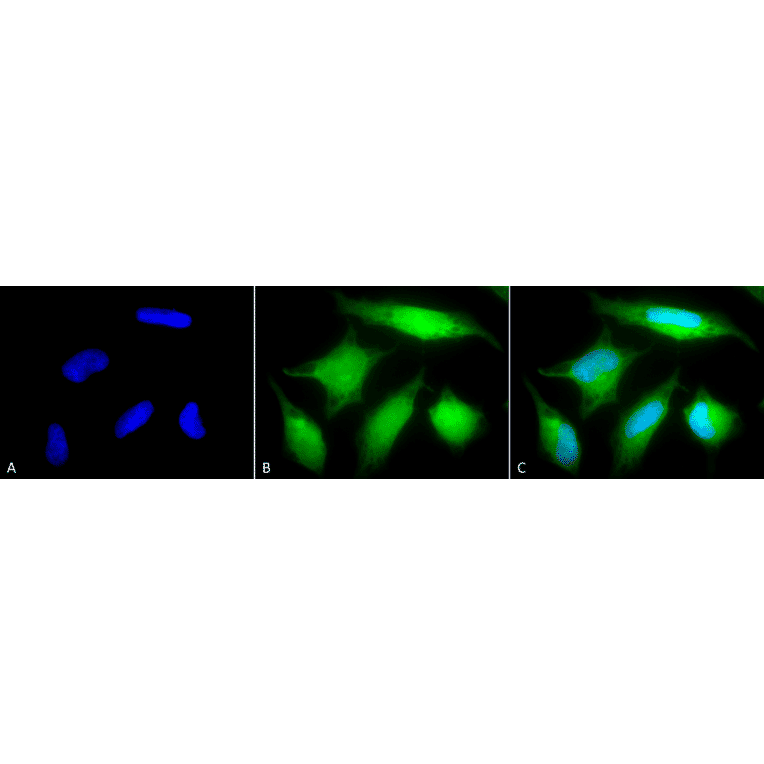Immunocytochemistry/Immunofluorescence - Anti-Rab5 Antibody (A305104) - Antibodies.com