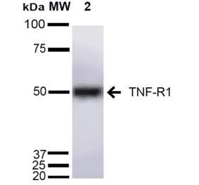 Western Blot - Anti-TNF Receptor I Antibody (A305105) - Antibodies.com