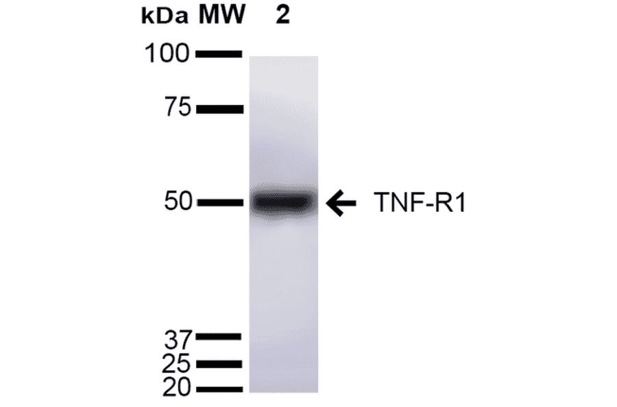 Western Blot - Anti-TNF Receptor I Antibody (A305105) - Antibodies.com