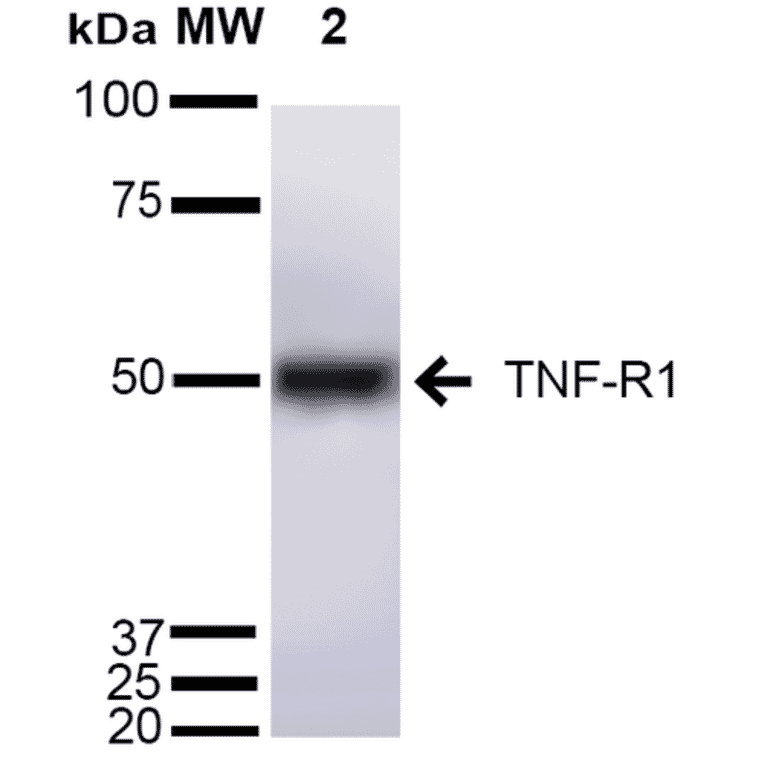 Western Blot - Anti-TNF Receptor I Antibody (A305105) - Antibodies.com