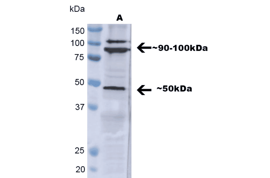 Western Blot - Anti-TNF Receptor I Antibody (A305105) - Antibodies.com