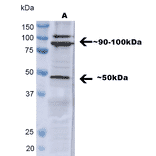 Western Blot - Anti-TNF Receptor I Antibody (A305105) - Antibodies.com