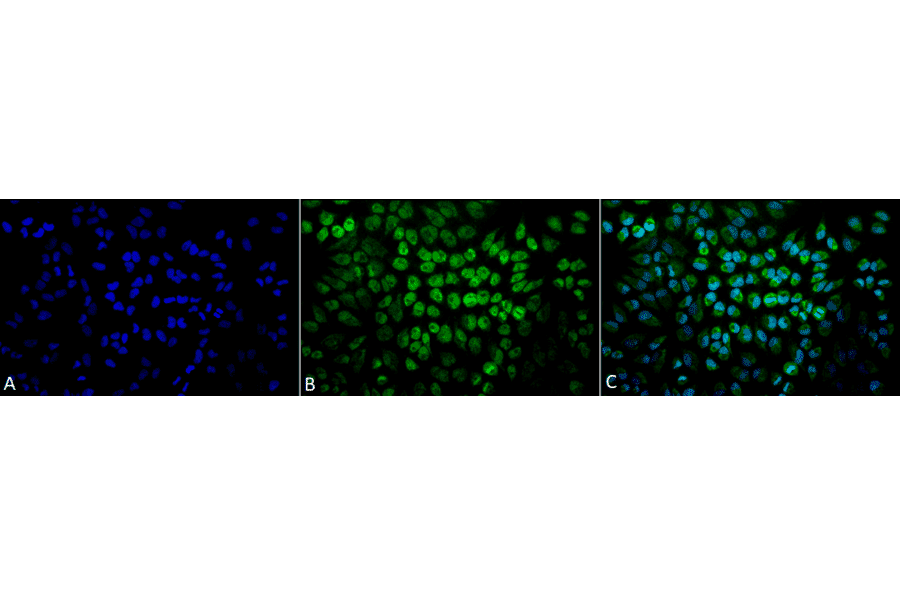 Immunocytochemistry/Immunofluorescence - Anti-TNF Receptor I Antibody (A305105) - Antibodies.com