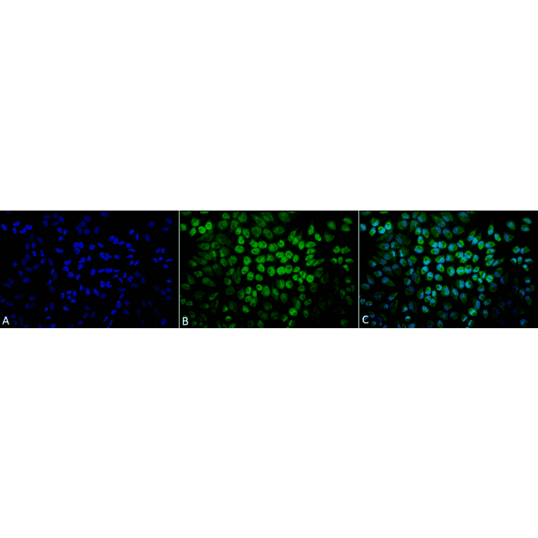 Immunocytochemistry/Immunofluorescence - Anti-TNF Receptor I Antibody (A305105) - Antibodies.com