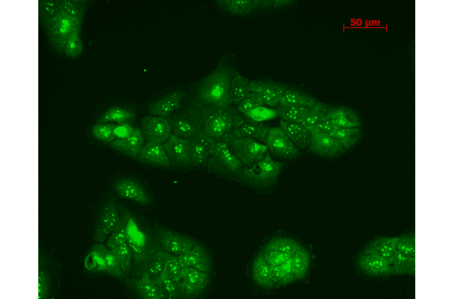 Immunocytochemistry/Immunofluorescence - Anti-TNF Receptor I Antibody (A305105) - Antibodies.com