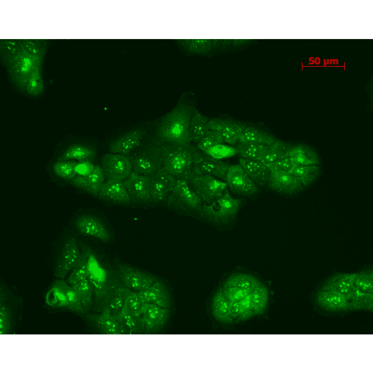 Immunocytochemistry/Immunofluorescence - Anti-TNF Receptor I Antibody (A305105) - Antibodies.com