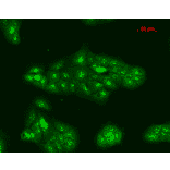 Immunocytochemistry/Immunofluorescence - Anti-TNF Receptor I Antibody (A305105) - Antibodies.com