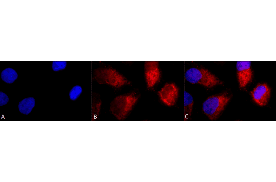 Immunocytochemistry/Immunofluorescence - Anti-TNF Receptor I Antibody (A305105) - Antibodies.com