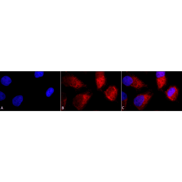 Immunocytochemistry/Immunofluorescence - Anti-TNF Receptor I Antibody (A305105) - Antibodies.com