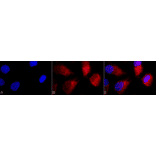 Immunocytochemistry/Immunofluorescence - Anti-TNF Receptor I Antibody (A305105) - Antibodies.com