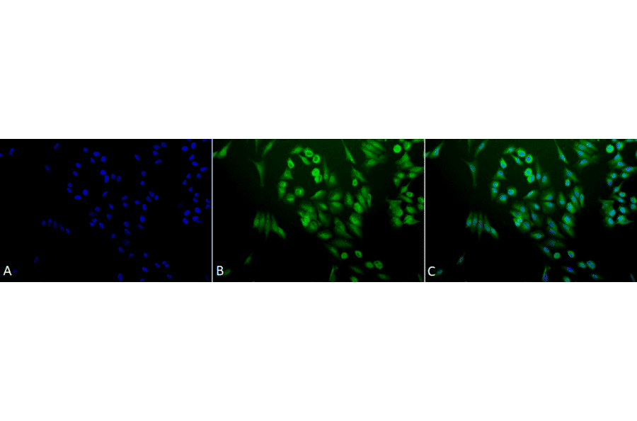 Immunocytochemistry/Immunofluorescence - Anti-Ubiquitin Antibody (A305108) - Antibodies.com