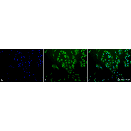Immunocytochemistry/Immunofluorescence - Anti-Ubiquitin Antibody (A305108) - Antibodies.com