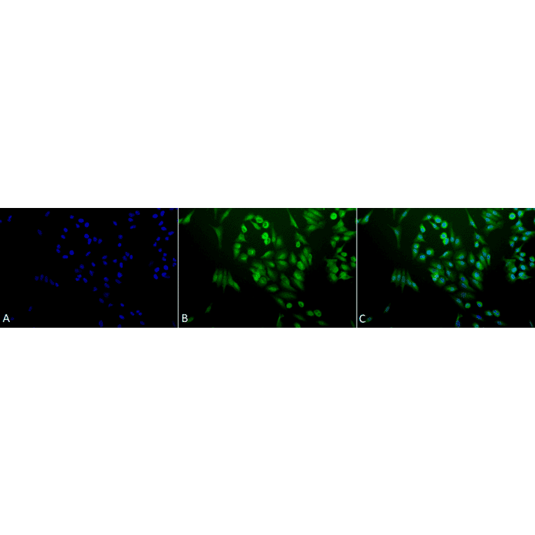 Immunocytochemistry/Immunofluorescence - Anti-Ubiquitin Antibody (A305108) - Antibodies.com