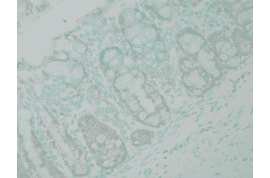 Immunohistochemistry - Anti-Ubiquitin Antibody (A305108) - Antibodies.com