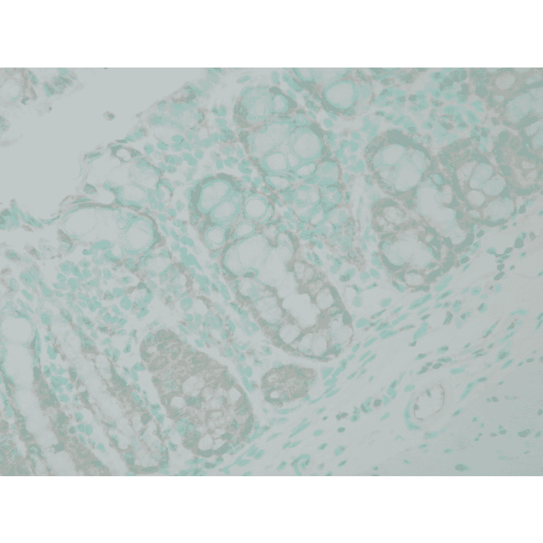 Immunohistochemistry - Anti-Ubiquitin Antibody (A305108) - Antibodies.com
