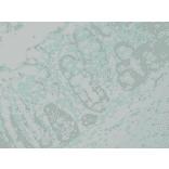 Immunohistochemistry - Anti-Ubiquitin Antibody (A305108) - Antibodies.com